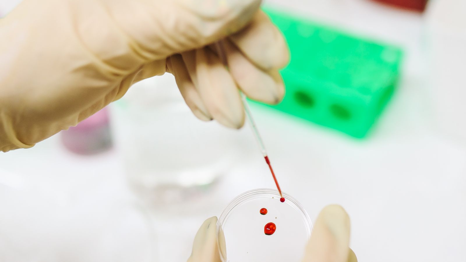 Close-up of a gloved scientist's hands examining a blood sample vial in a laboratory.